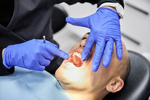 Best Emergency Dental Care for Broken or Chipped Teeth in Red Chute, LA