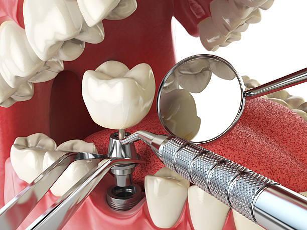 Best Weekend Emergency Dentist in Red Chute, LA